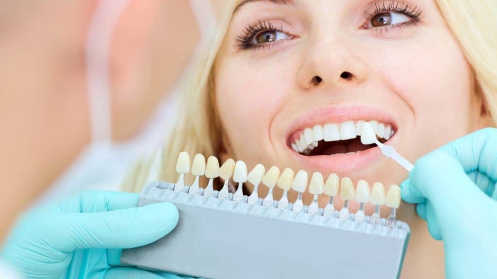 How to Choose the Right Teeth Whitening Tools for Your Dental Practice